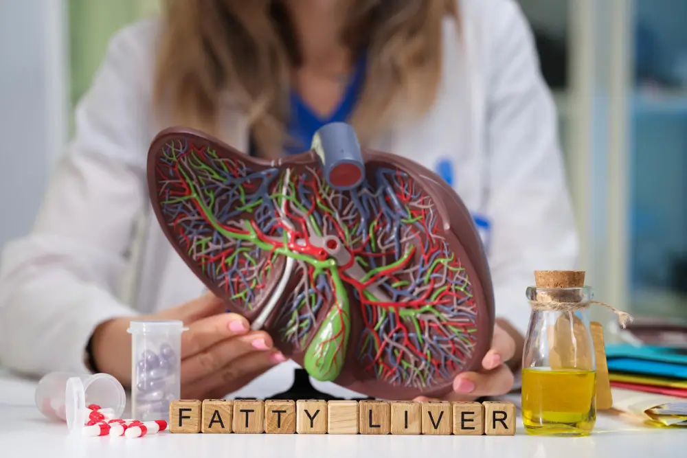 Understanding Metabolic Dysfunction-Associated Steatotic Liver Disease (MASLD)